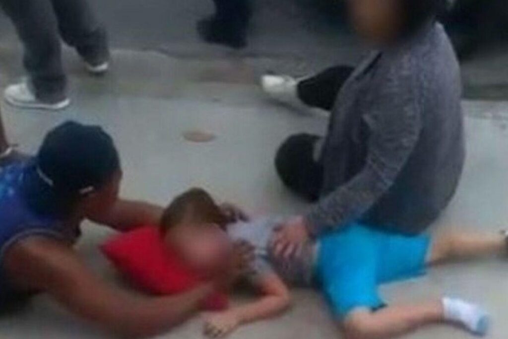 A criança teve luxação no rosto e quebrou uma das pernas