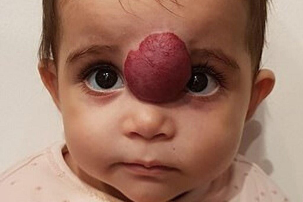 A cirurgia aconteceu em julho de 2019