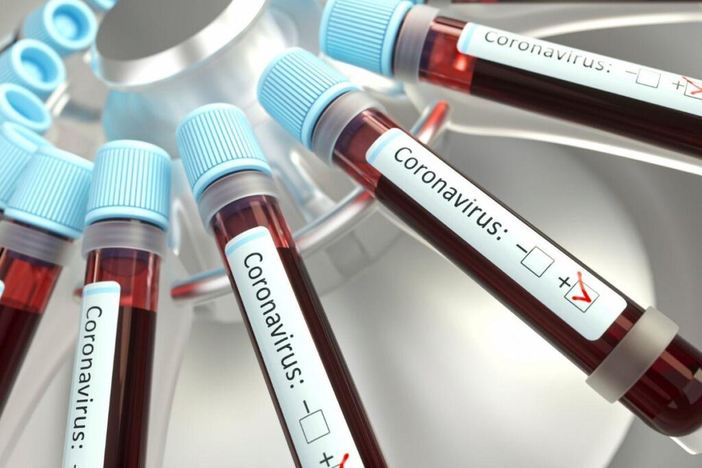 Serão disponibilizados 22,9 milhões de testes