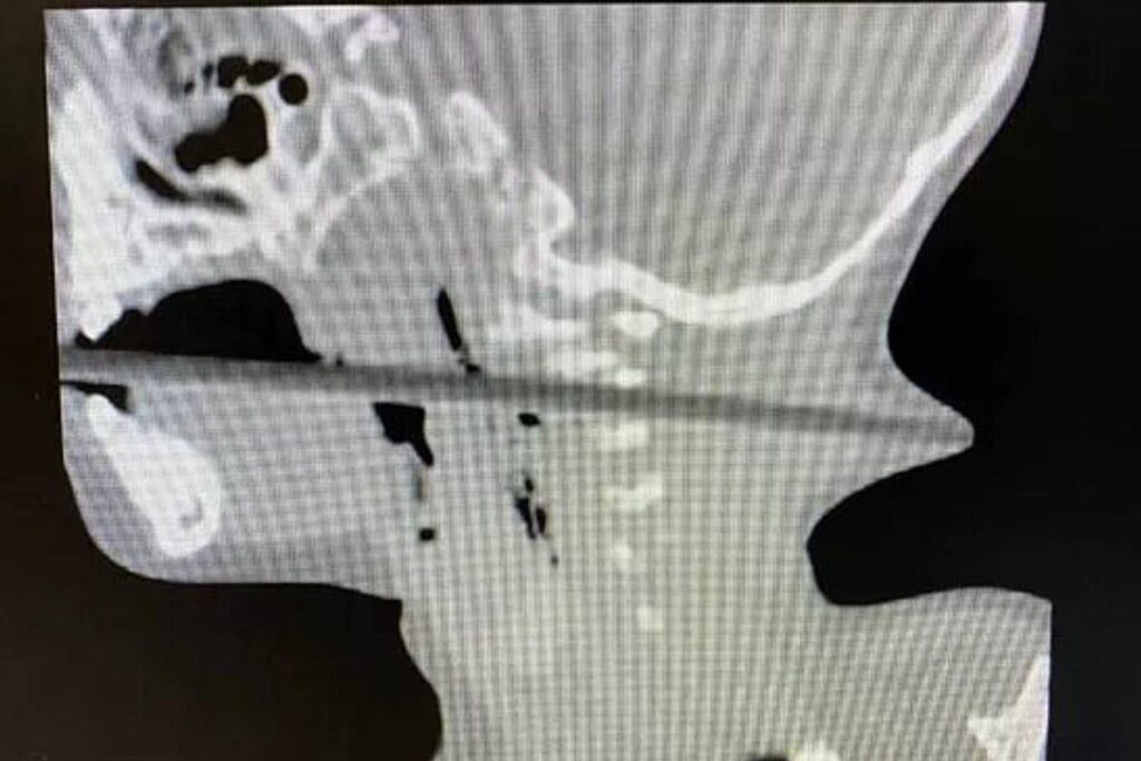 As imagens são desesperadoras