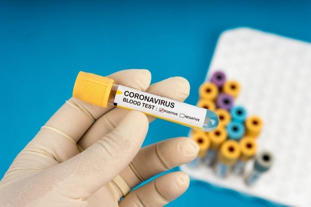 A pandemia de coronavírus foi anunciada no mundo em 11 de março de 2020