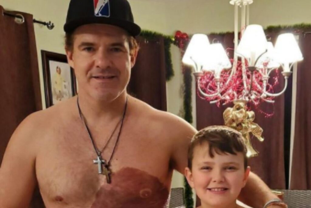 Derek Prue junto do filho, Derek Jr. , com a mesma marca de nascença!