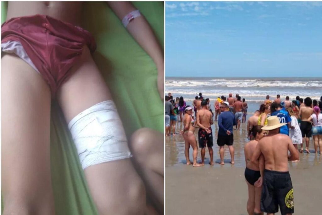 Menino é ferido por tubarão