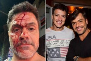 Irmão de Rodrigo Faro após acidente de carro