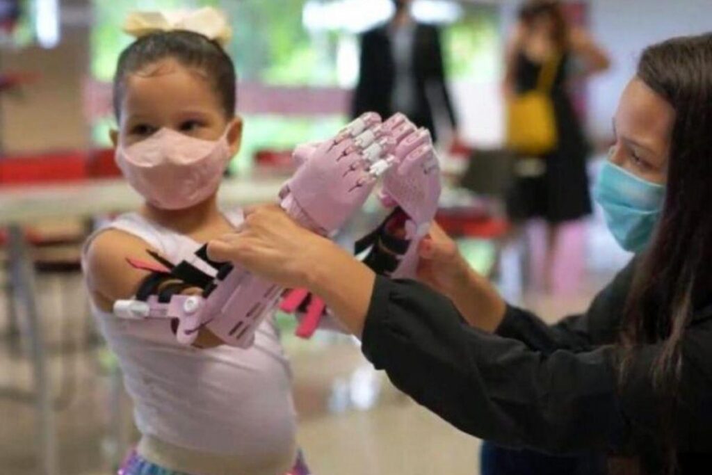 Maria Beattriz ganhou as próteses de mão