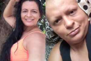 Os médicos disseram que era apenas gordura nos seios