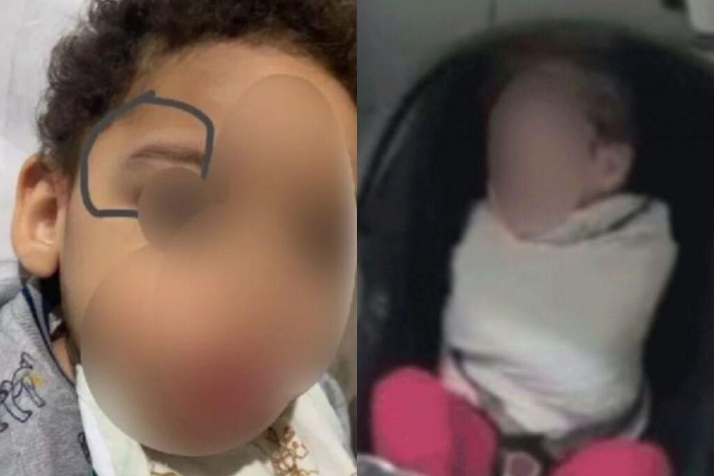 As crianças apareceram com hematomas e falta de ar após sair do berçário