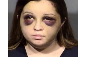 A mulher matou a bebê e depois fugiu do hospital, onde foi encontrada com hematomas no rosto