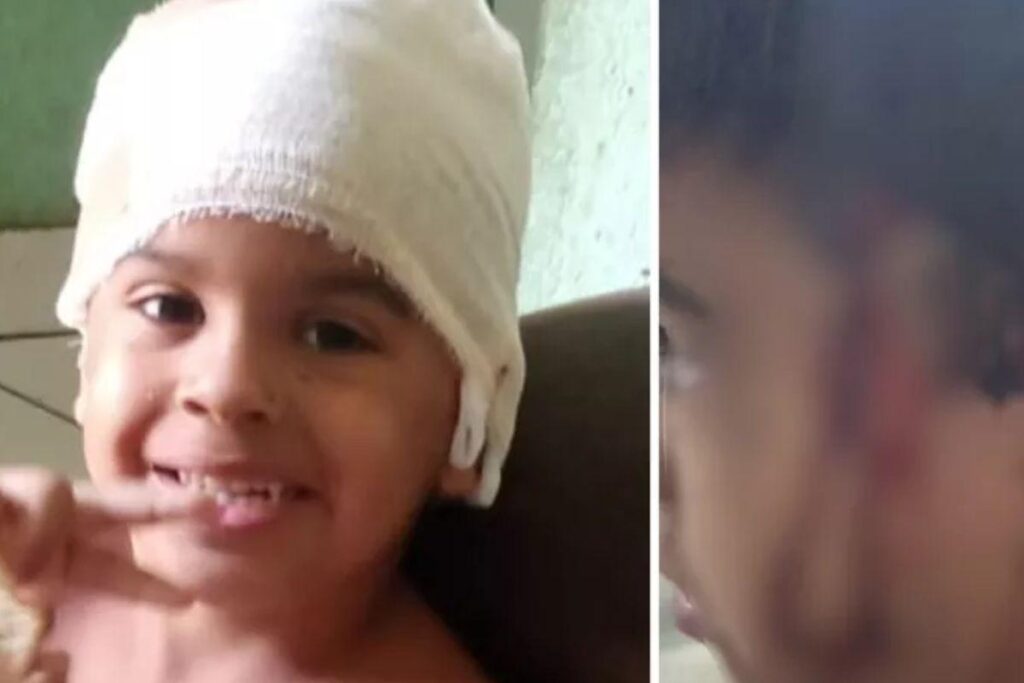 A criança perdeu a parte mais fina da orelha, segundo explicação da mãe