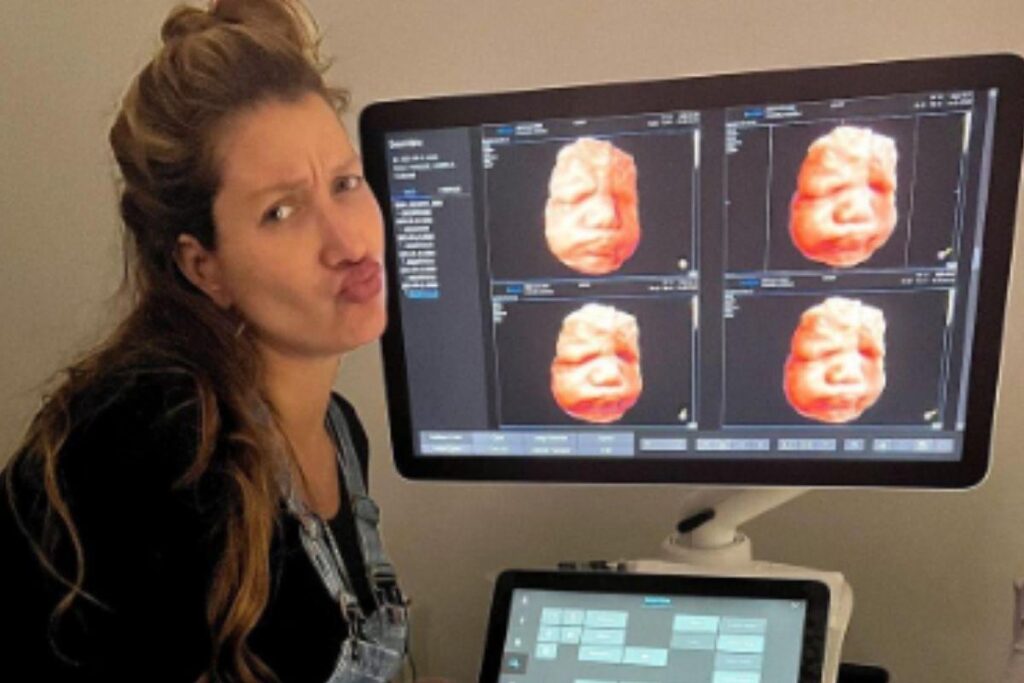 Gabriela Pugliesi vê rosto do primeiro filho em ultrassom