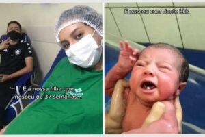 Bebê nascer com dente é normal? Saiba por que acontece, quando extrair e como cuidar