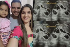 Ultrassom dos seis bebês