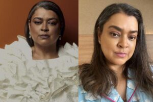 Preta Gil explicou as marcas de hematoma e cicatriz que ela tem