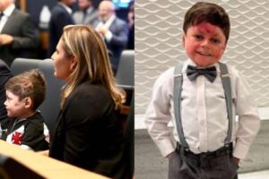 O projeto de lei foi apelidado em referência ao menino Guilherme que ficou conhecido nacionalmente
