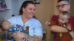 Gêmeos siameses são adotados após pais biológicos abrirem mão da guarda