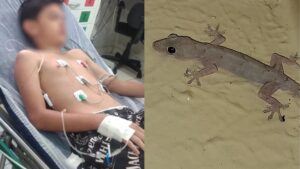 Menino teve graves sintomas de infecção alimentar