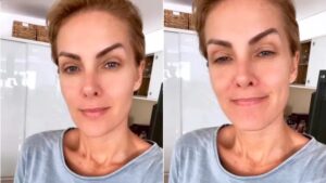 Ana Hickmann