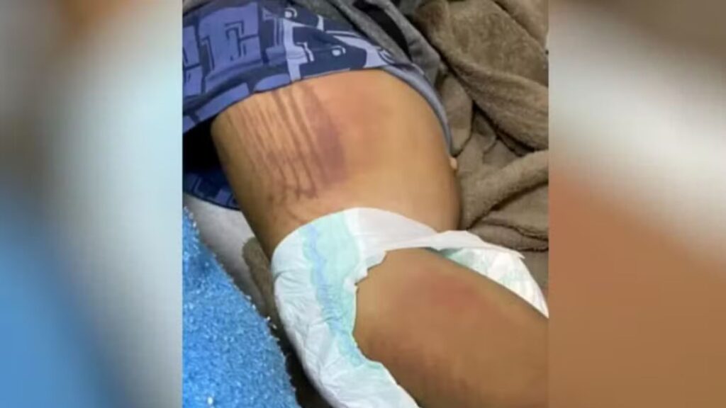 O bebê foi agredido