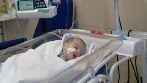 Após 3 anos no hospital, bebê que nasceu com intestino para fora do corpo recebe alta