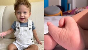 Bebê com pés em formato de coração faz sucesso nas redes sociais: “Parte mais linda dele”