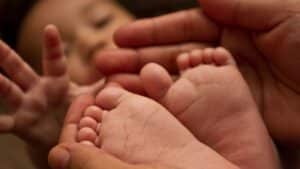 Icterícia neonatal: o que é, como identificar e quando se preocupar
