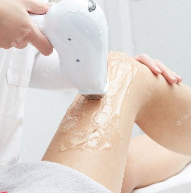Quer Fazer Depilação a Laser? Não Cometa Esse Erro Comum!