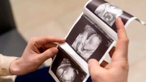 Depois de três abortos, ela viveu algo raro: engravidou duas vezes no mesmo mês