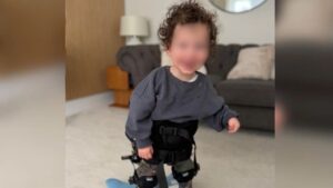 Bebê tem doença rara que pode causar paralisia quando fica animado